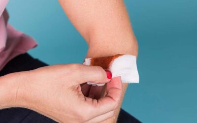 「血小板裂解液」可促進傷口癒合